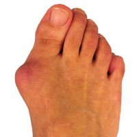 /album/pre-porozumenie-vid-foto1/halux-jpg2/